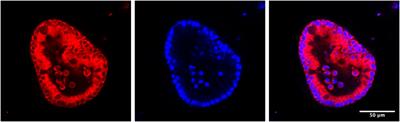 Iron-tracking strategies: Chaperones capture iron in the cytosolic labile iron pool